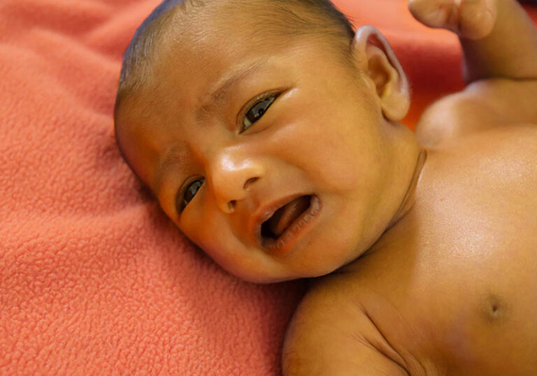 زردی نوزاد: از دلایل تا راهکارهای درمانی | نی‎نی‎جو