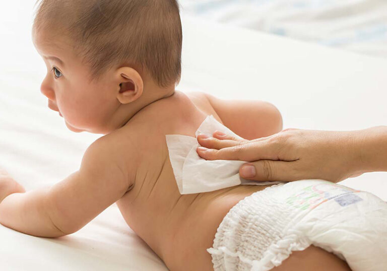 نکات مهم در مراقبت از پوست نوزادان | نی‎نی‏جو